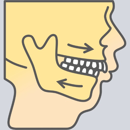 skeletal