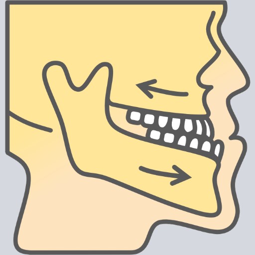 skeletal